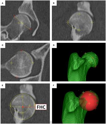 Introduction of a bone-centered three-dimensional coordinate system enables computed tomographic canine femoral angle measurements independent of positioning